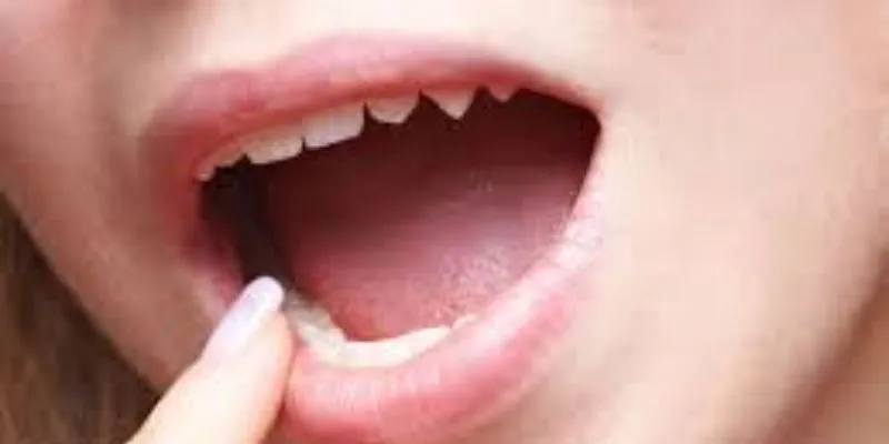 10 nơi bẩn nhất